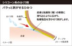 画像2: キャビロン　皮膚用リムーバー（1本） (2)